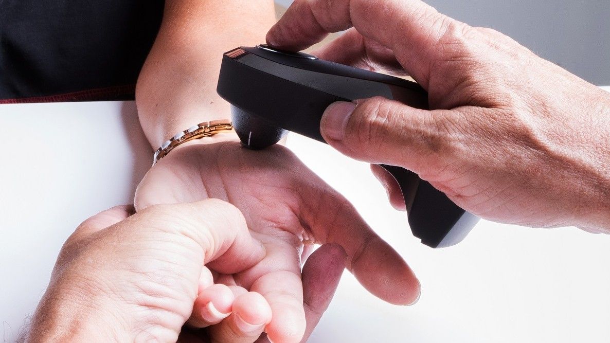 Oligoscan scan oligoélement et minéraux corps